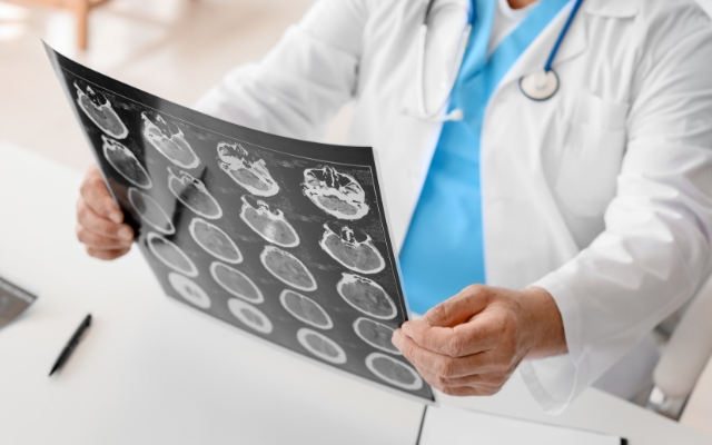 Top Neurologists in San Marco, FL
