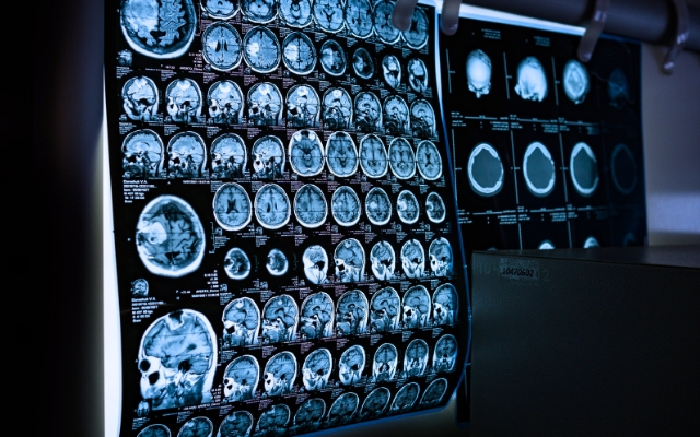 Top Neurologists in Windy Hill, FL