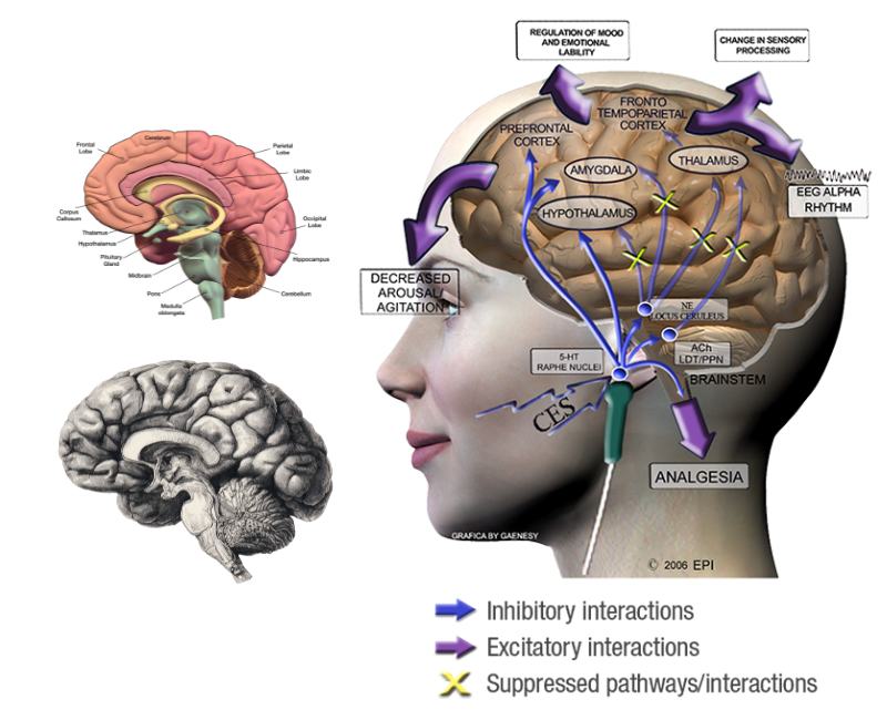 Alpha Stimulation (Alpha-Stim) Therapy in Jacksonville, FL