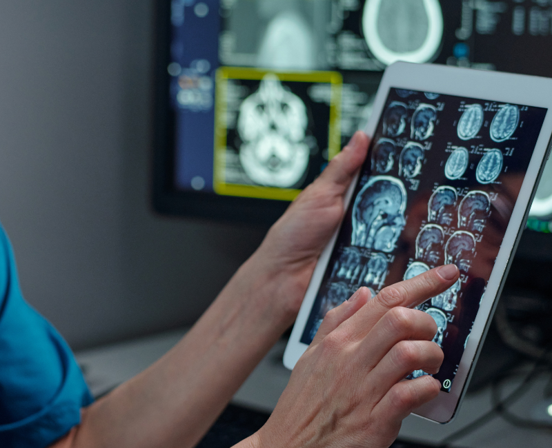 Brain MRI Monitoring in Jacksonville, FL