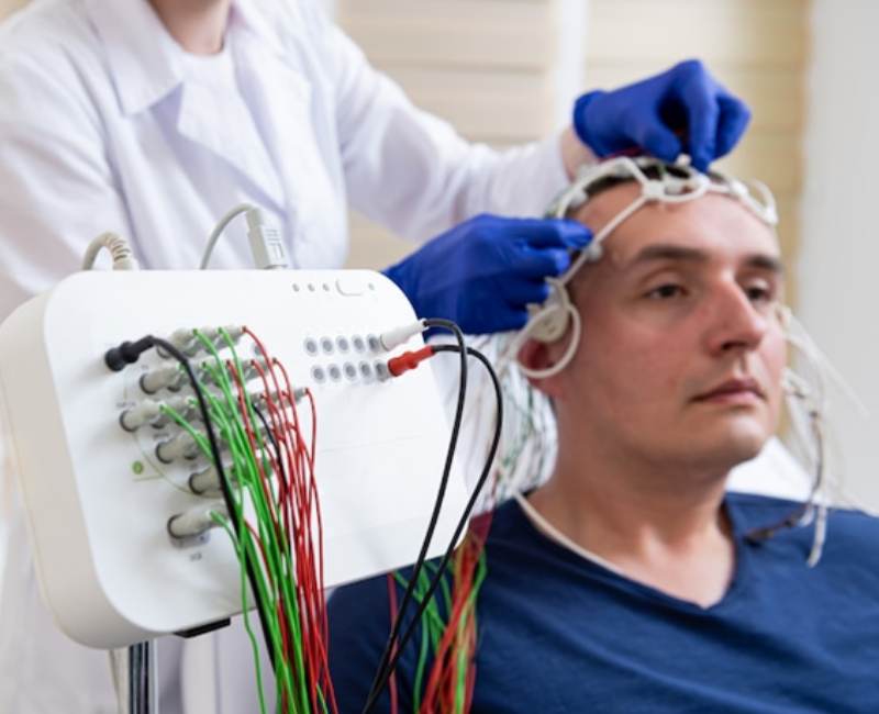 Electroencephalogram