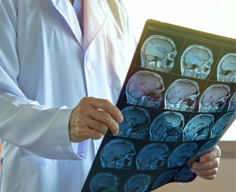 Neurobiofeedback Therapy in Jacksonville, FL