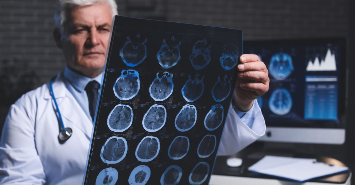 signs of nerve damage
